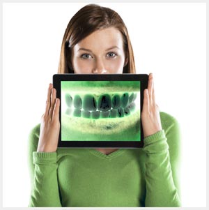 Dental Hardware and Software Integration